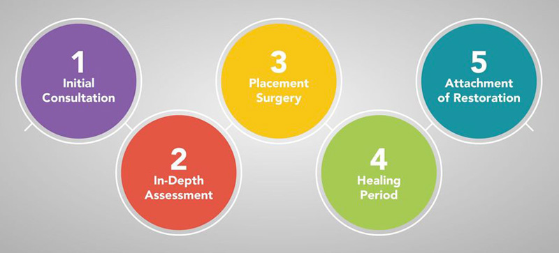 dental-implant-timeline